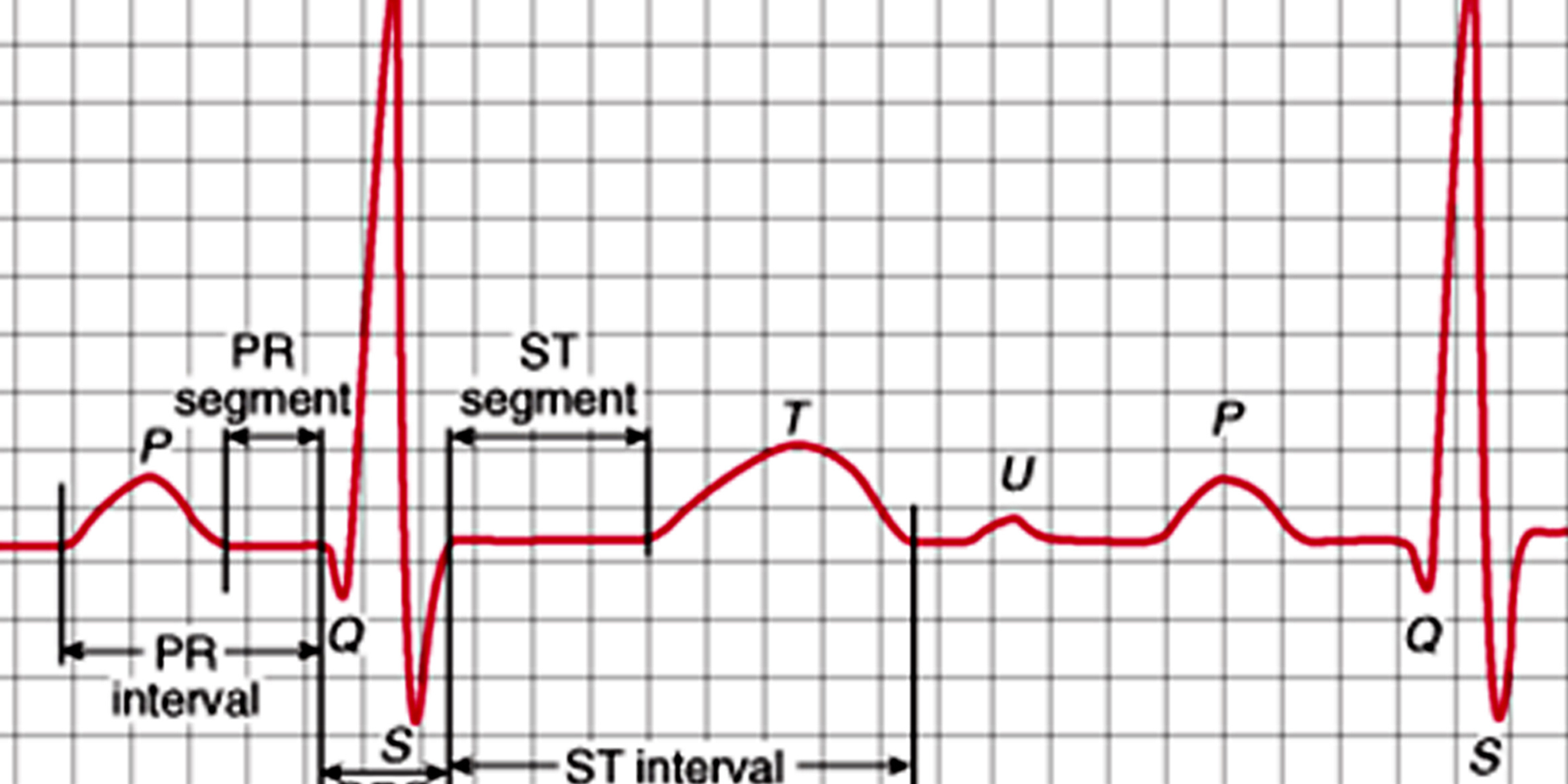 Electrocardiogram